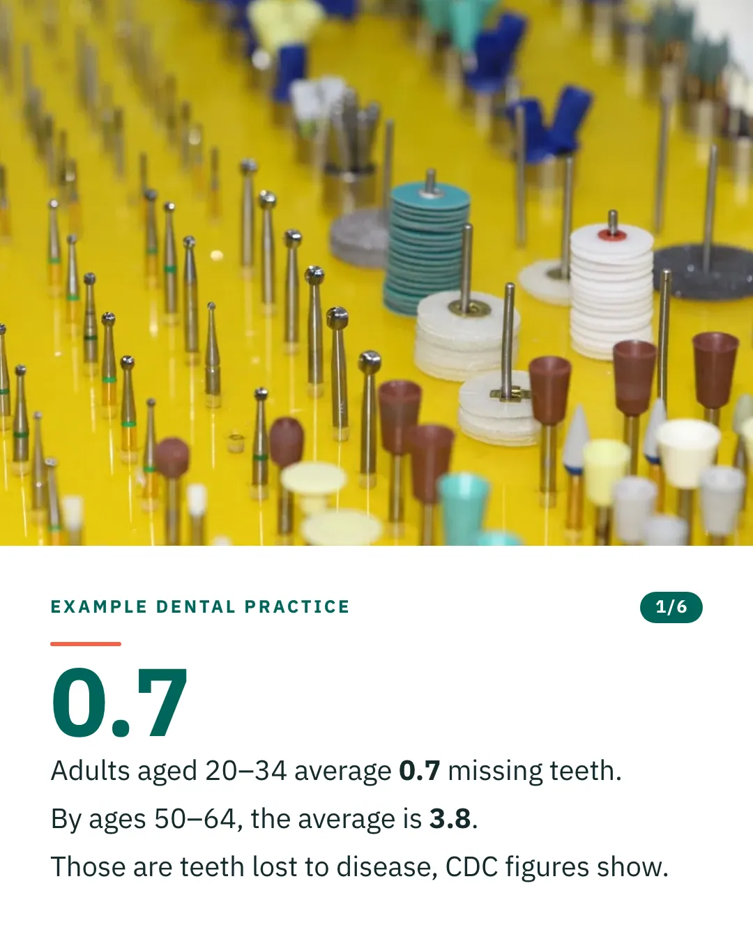 Slide 1 of 6. Card reading: Adults aged 20–34 average 0.7 missing teeth. By ages 50–64, the average is 3.8. Those are teeth lost to disease, CDC figures show. Above the words, a photograph: Dental burs, polishing discs and rubber polishing cups standing in rows on a yellow board. (CC0).