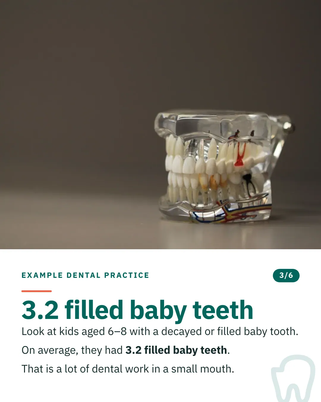 Slide 3 of 6. Card reading: Look at kids aged 6–8 with a decayed or filled baby tooth. On average, they had 3.2 filled baby teeth. That is a lot of dental work in a small mouth. Above the words, a photograph: A clear dental teaching model of upper and lower jaws with a full set of teeth. (CC0).